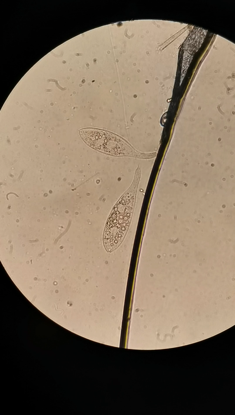 漫游虫悠闲漫步