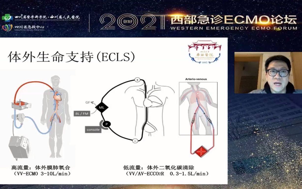 VVECMO的机械通气策略ⷨ𕖥𗍂𗥛›川大学华西医院哔哩哔哩bilibili