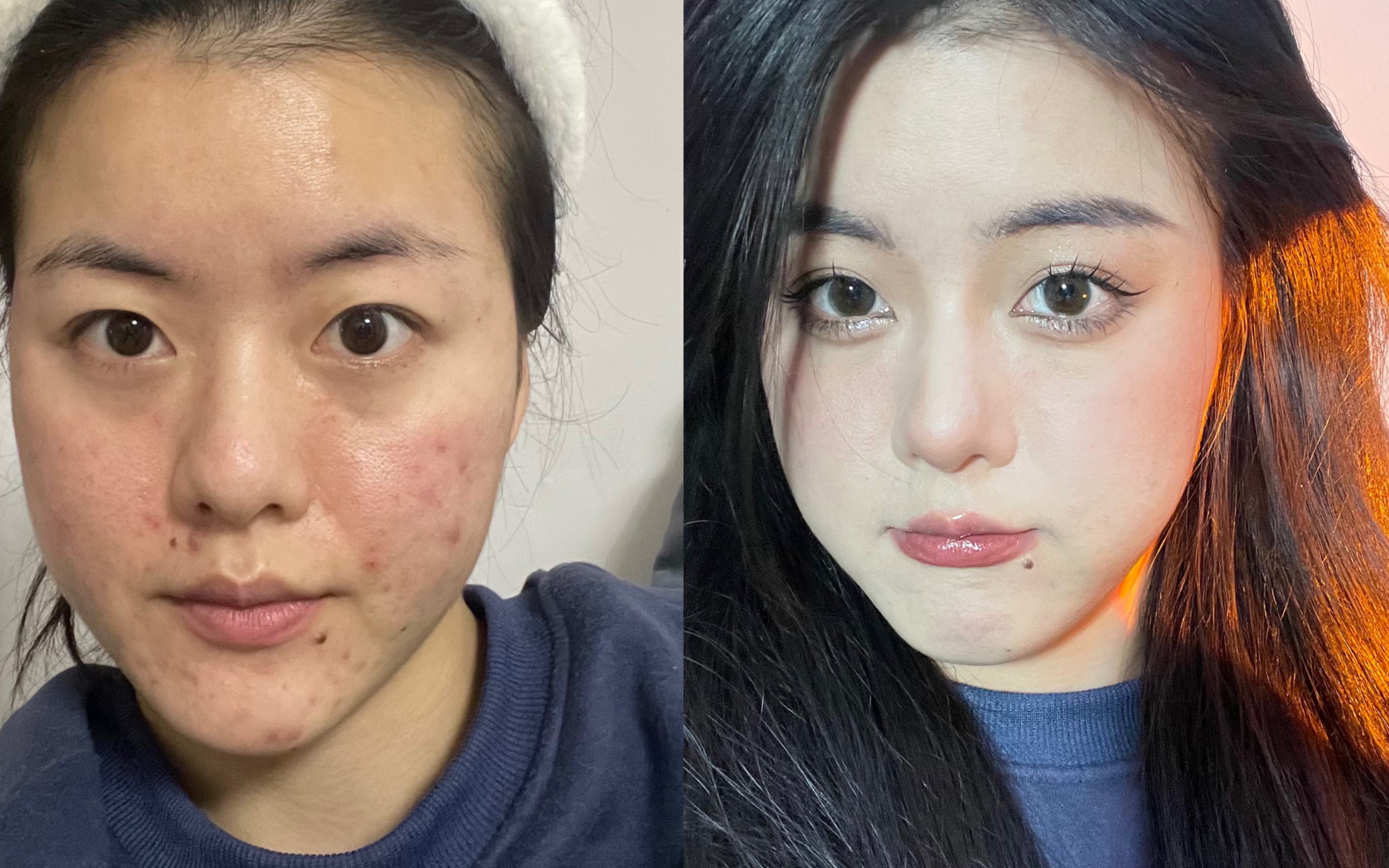 普通人瑕疵皮怎么化妆才能颜值最大化?_哔哩哔哩_bilibili