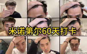 Download Video: 我觉得我不会相信其他任何一家生发产品了！