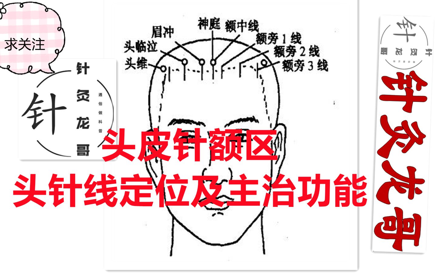 跟着龙哥学针灸(二):头皮针额区头穴线定位及主治功能哔哩哔哩bilibili