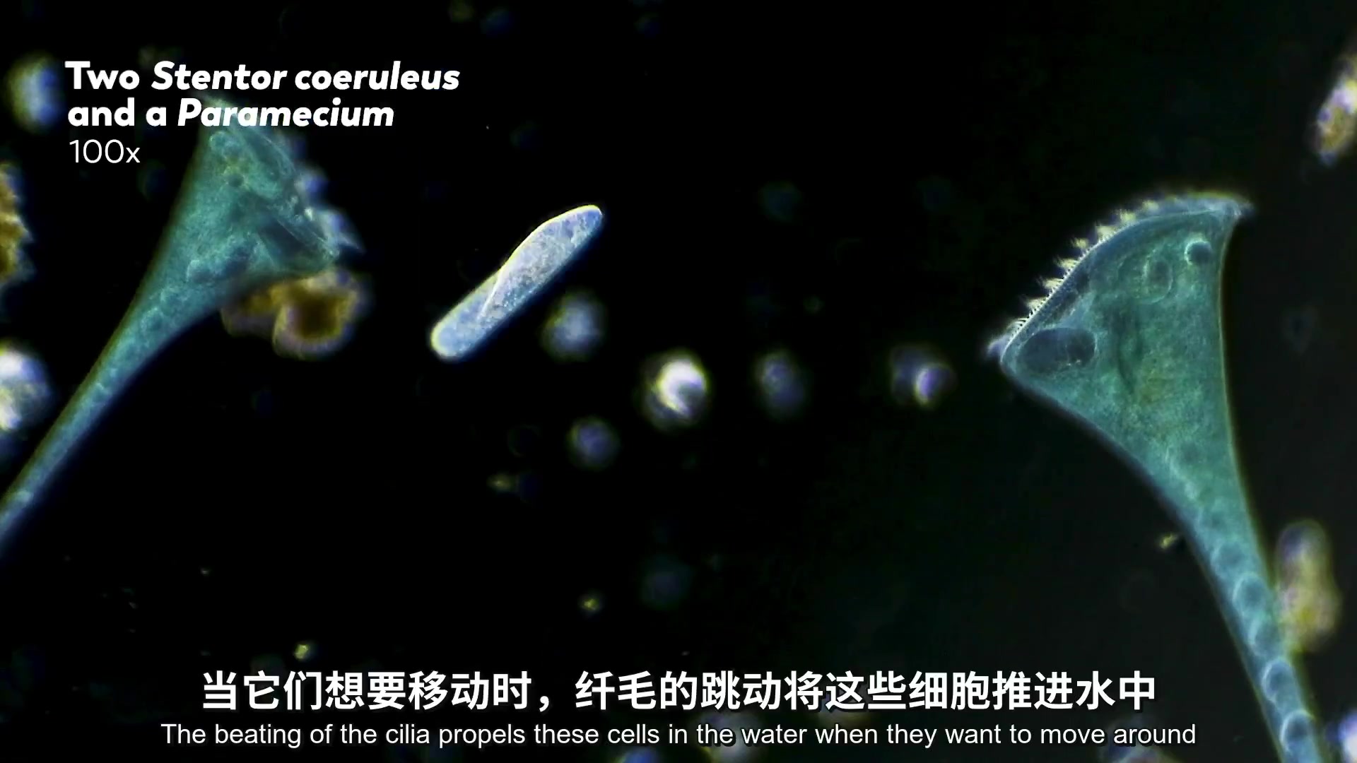 [图]超级单细胞生物：Stentors