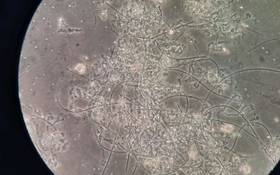 钢丝绒泡菌图片