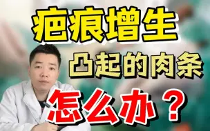 下载视频: 疤痕增生凸起的肉条怎么办？