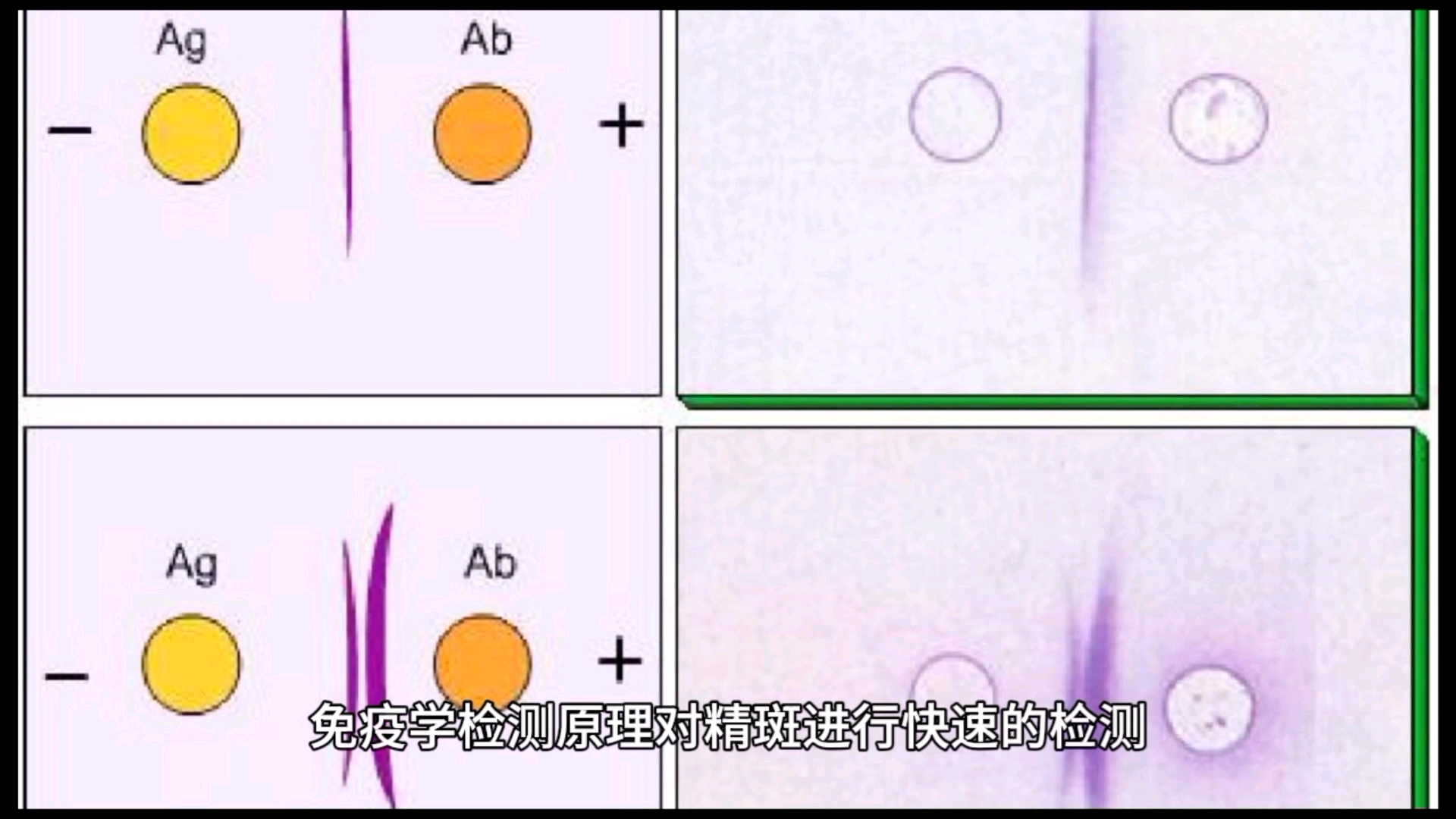 精斑检测方法,纸巾、车座、内裤上精斑简单检测!实验哔哩哔哩bilibili