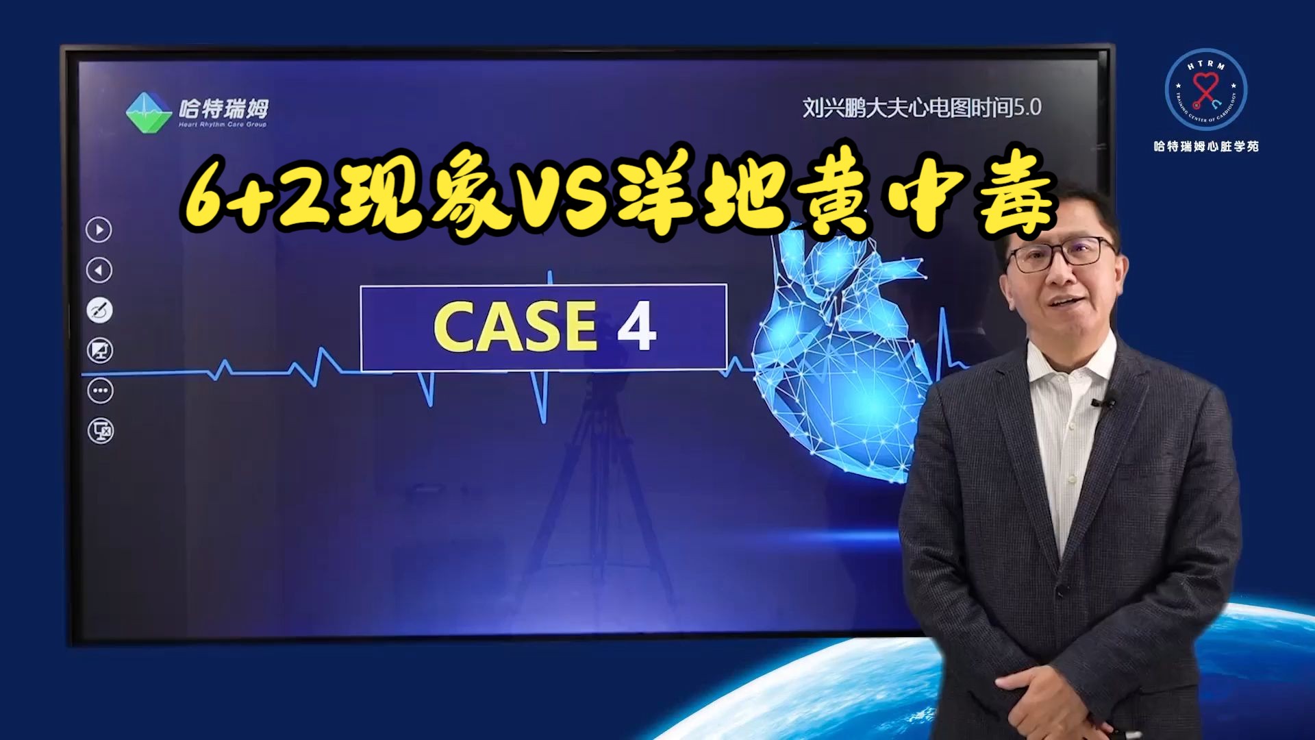 刘兴鹏心电图5.0 case4 洋地黄中毒与左主干病变鉴别哔哩哔哩bilibili