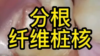 Download Video: 这样的牙齿能留下是需要点技术的！