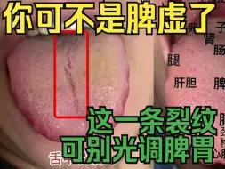 Descargar video: 你可不是脾虚了，光看裂纹去治脾胃，那就完蛋了