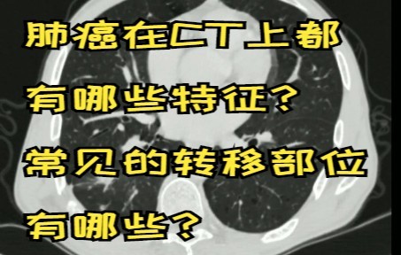 肺癌在CT上都有哪些特征?常见的转移部位有哪些?哔哩哔哩bilibili