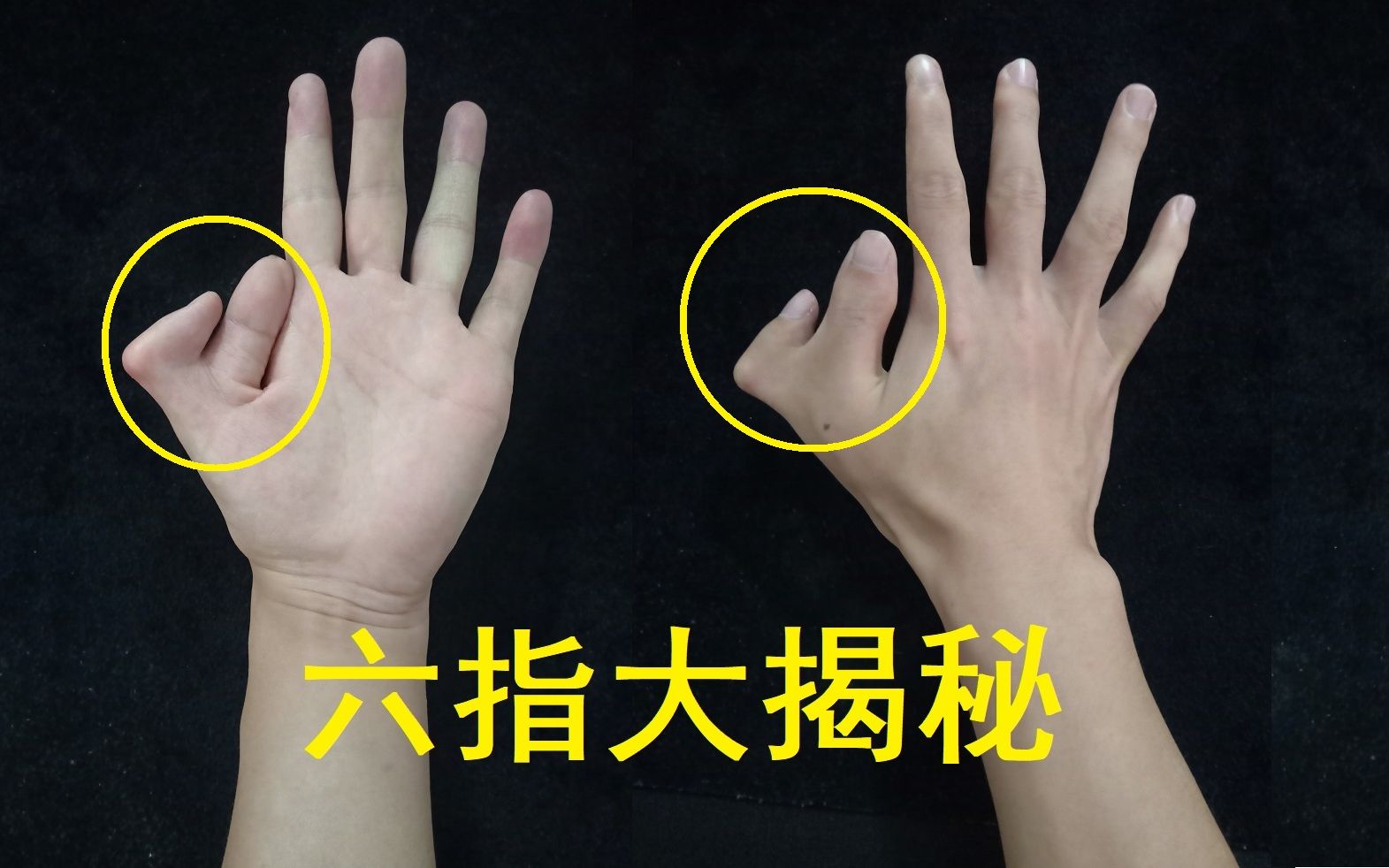 我是六指魔术师我的六指在左手还是右手现在揭晓答案