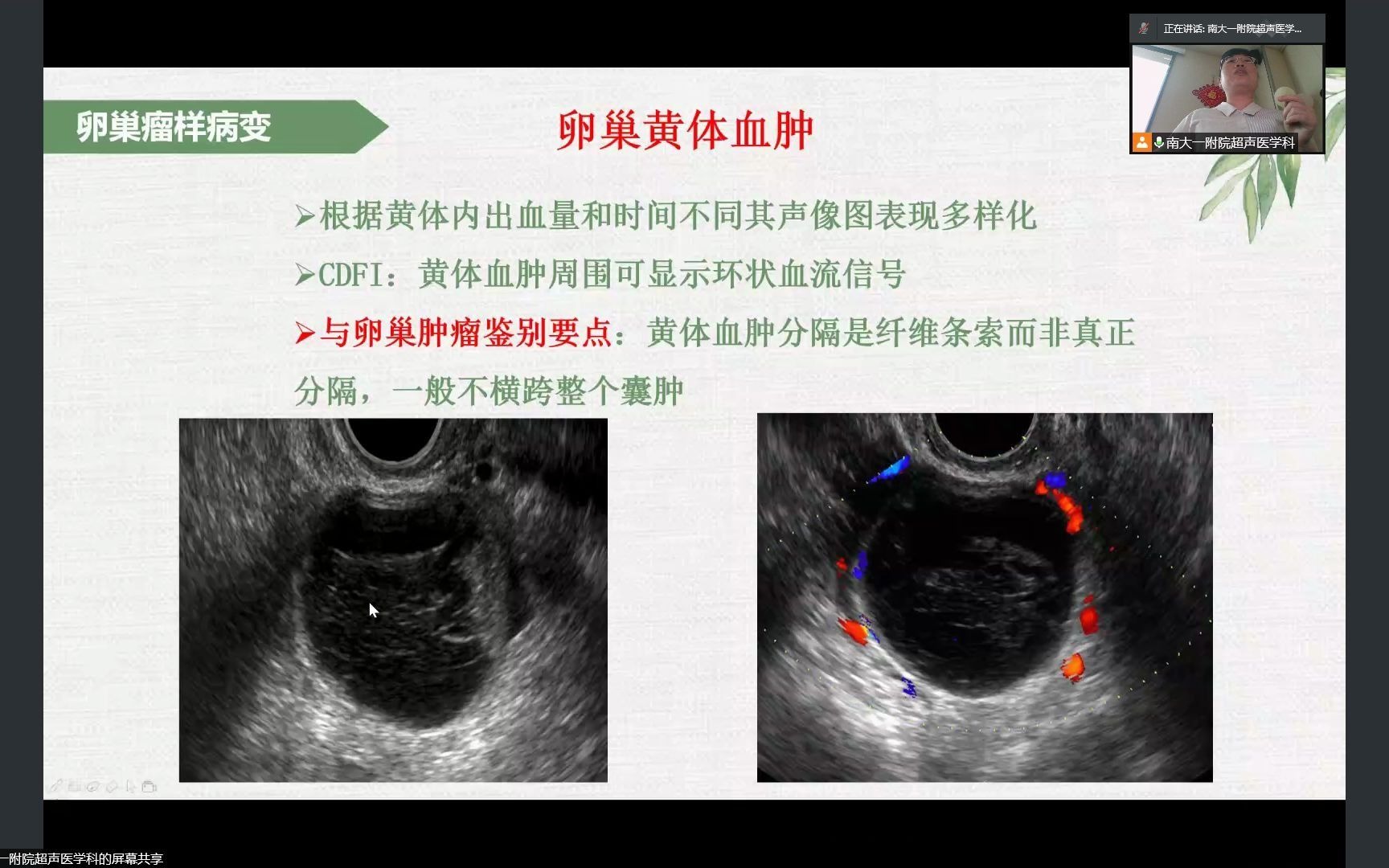 [图]妇科疾病的超声诊断