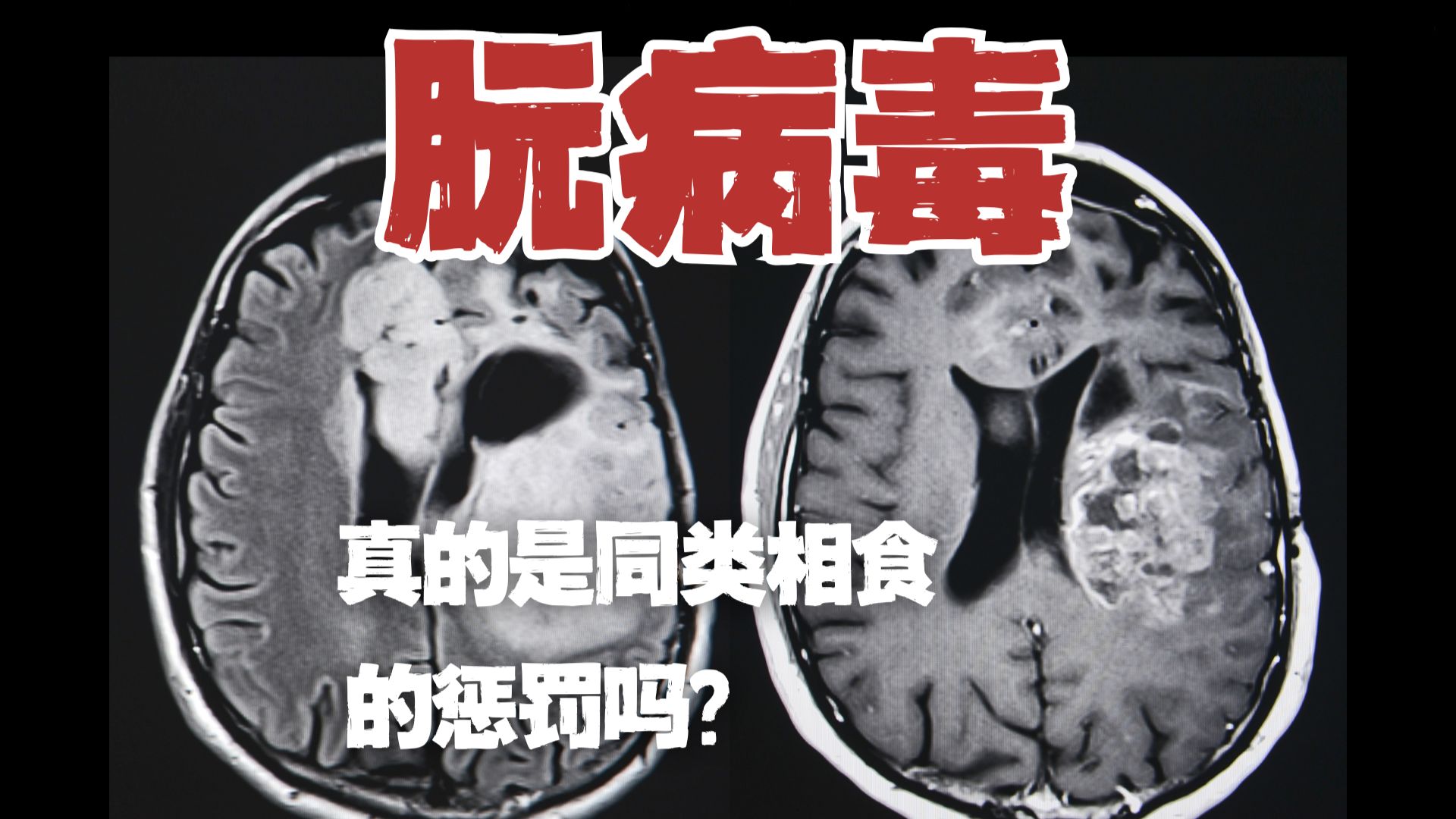 人类20号染色体上真有“神的禁令”？