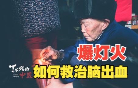 [图]2位亲人患病去世，84岁老人苦学中医，一种民间绝技如何治疗中风？