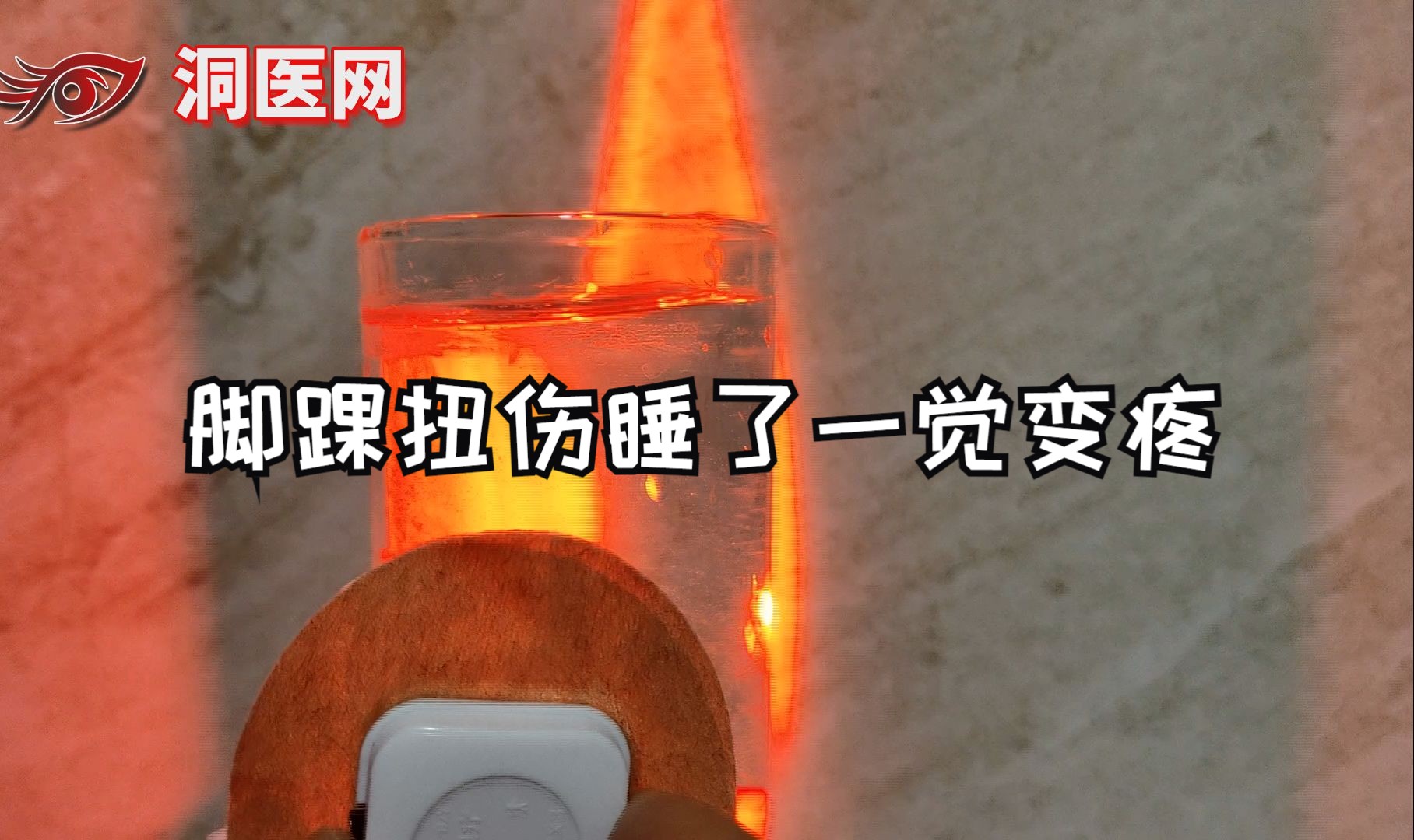 脚踝扭伤睡了一觉变疼了正常吗