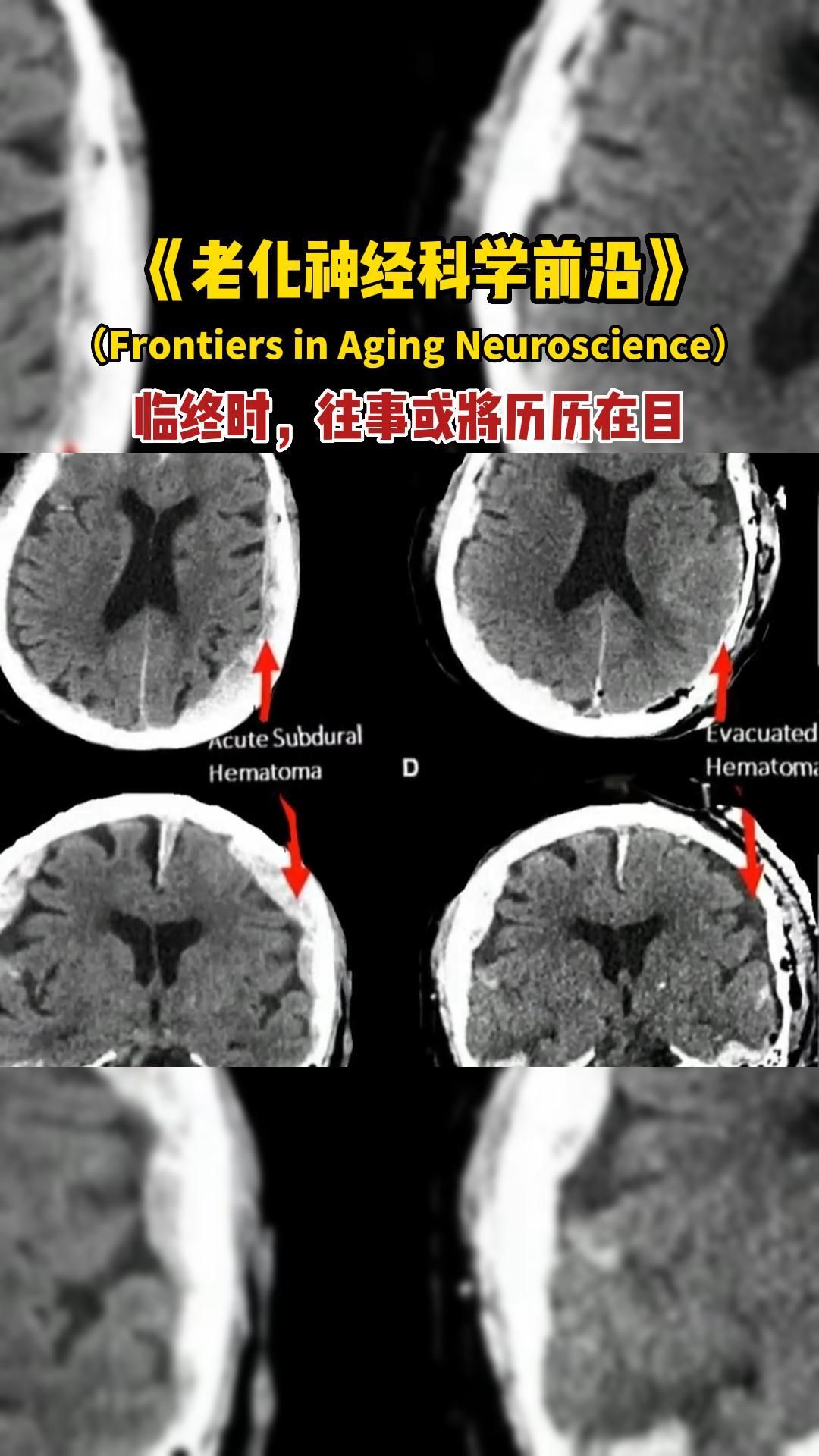 [图]老化神经科学前沿提出，人生放电影可能真的存在