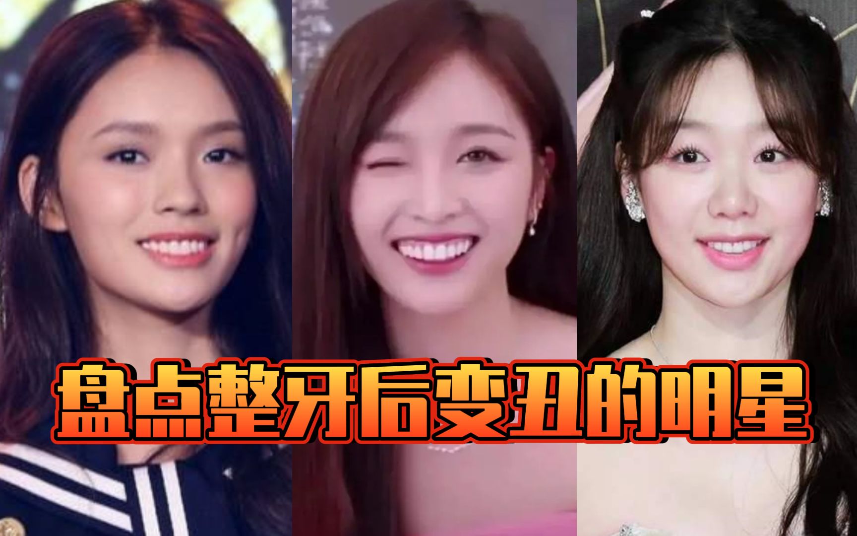 盘点整牙后变丑的明星