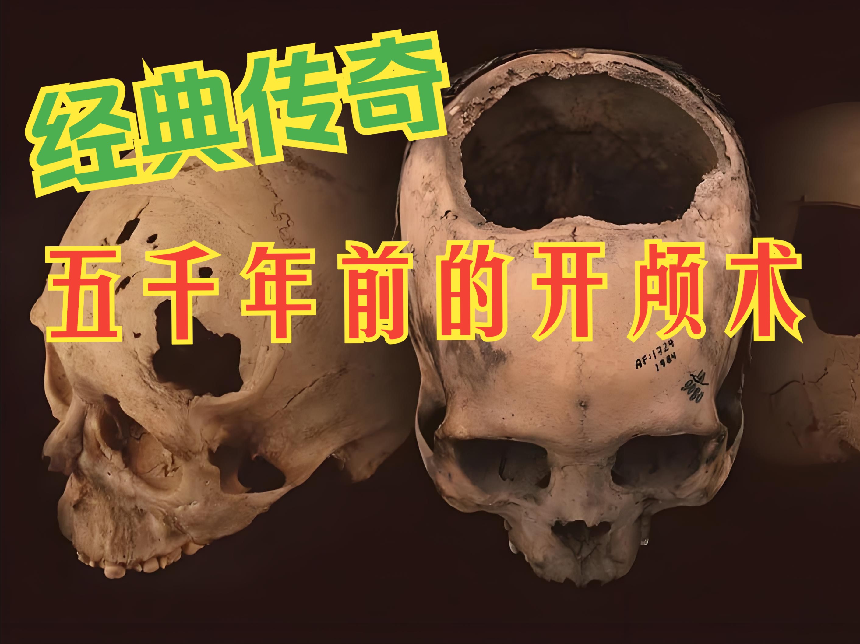 《经典传奇》 —— 五千年前的开颅术