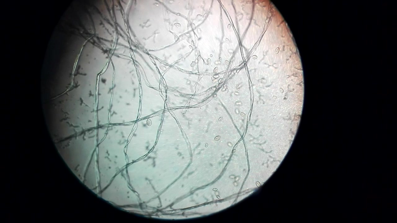 草履虫显微镜下图片