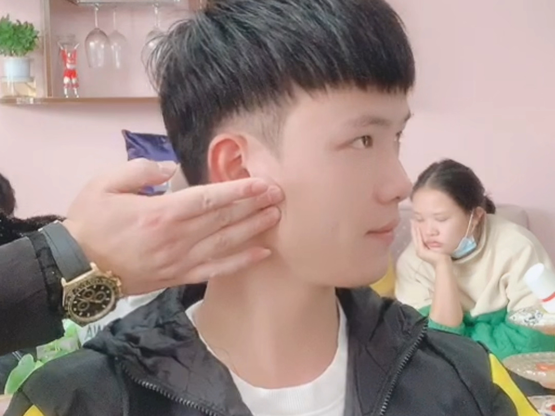 假发男植发(假发与植发有什么区别)