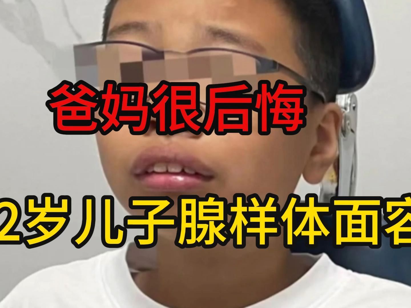 爸媽很後悔,12歲兒子腺樣體面容