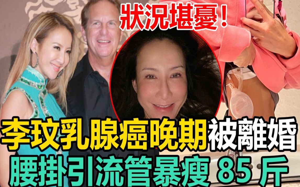 [图]47岁李玟乳腺癌晚期被离婚！为富豪老公搏命试管9次，腰挂引流管体重只剩42kg，大16岁丈夫不见踪影太希嘘#李玟