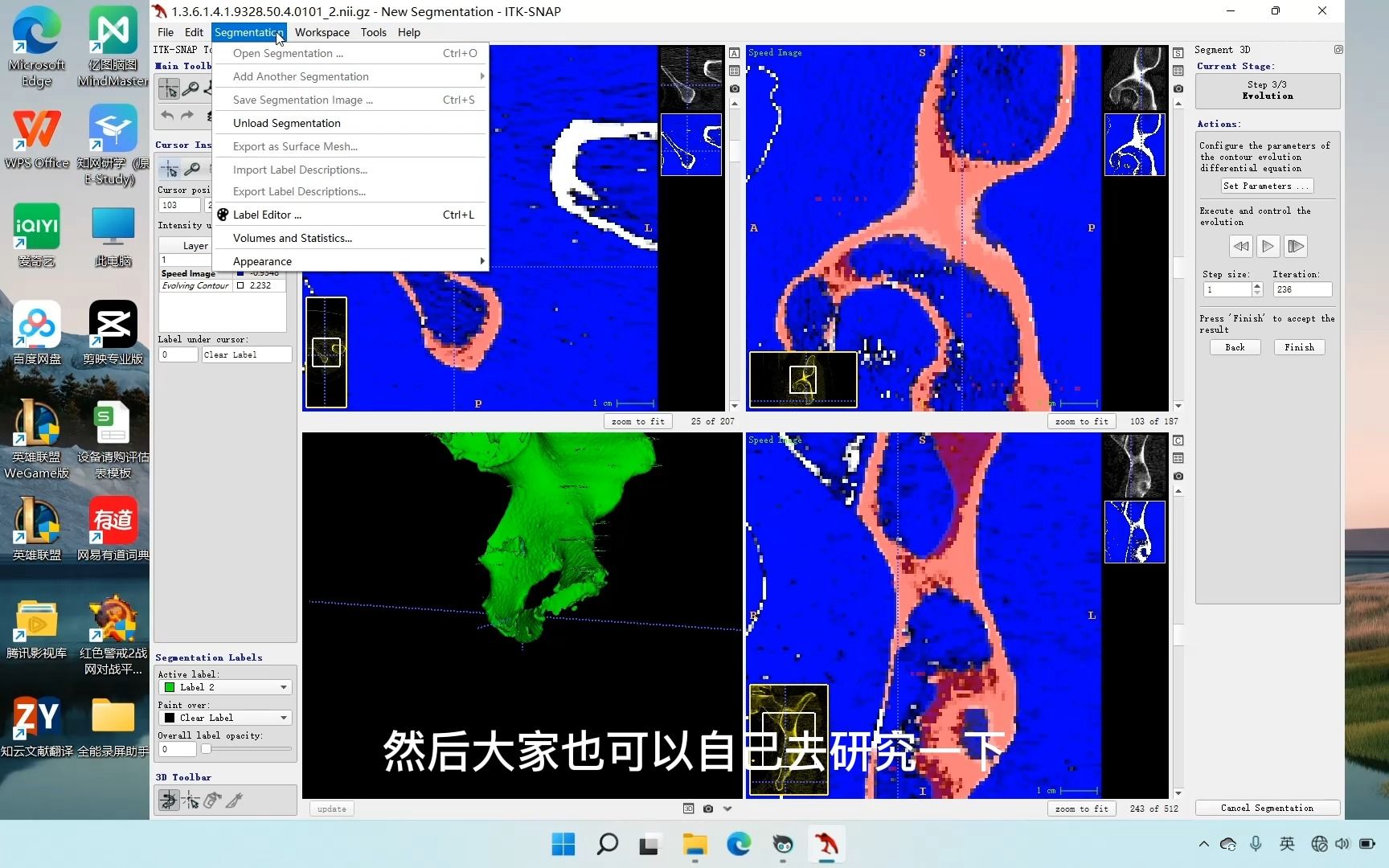 ITKsnap操作教程哔哩哔哩bilibili