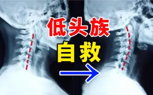 Tải video: 颈椎病10级强烈推荐！5分钟肩颈疼痛一遍就舒服！