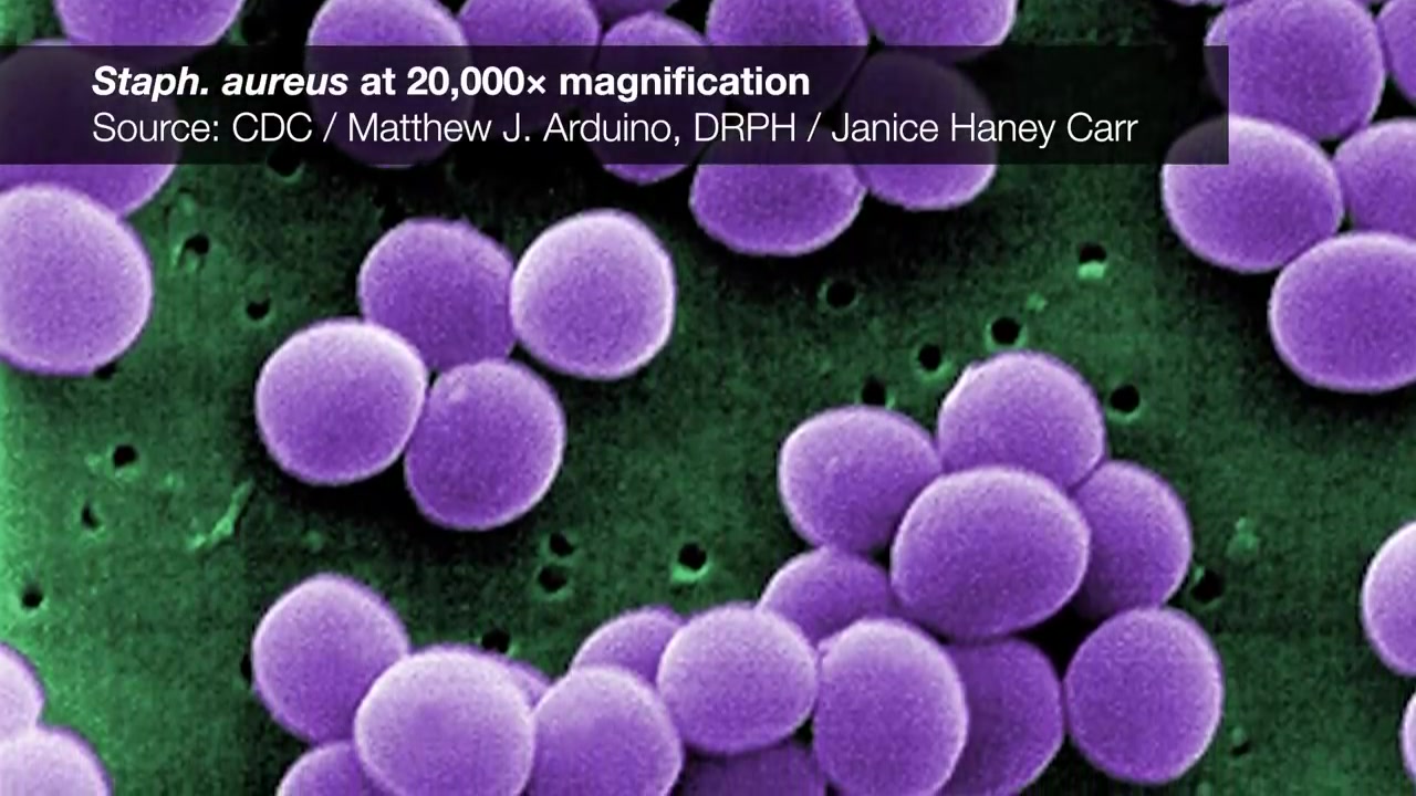 youtube煤油河的食脑变形虫