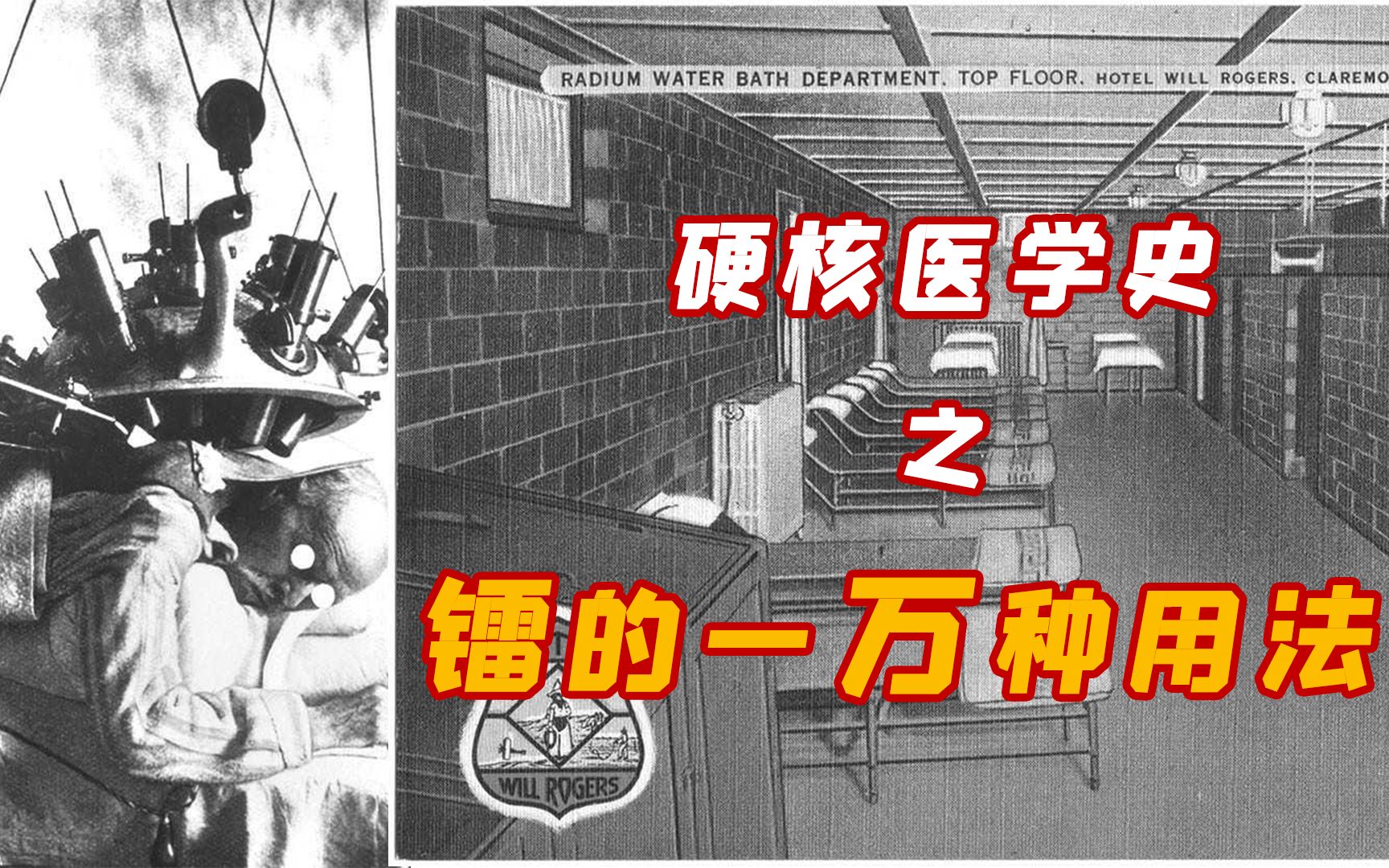 辐射疗法 近代西方的科技与狠活【硬核医学史02】【光速小王】哔哩哔哩bilibili