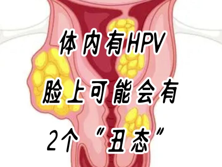 体内有hpv,脸上会有2个"丑态"