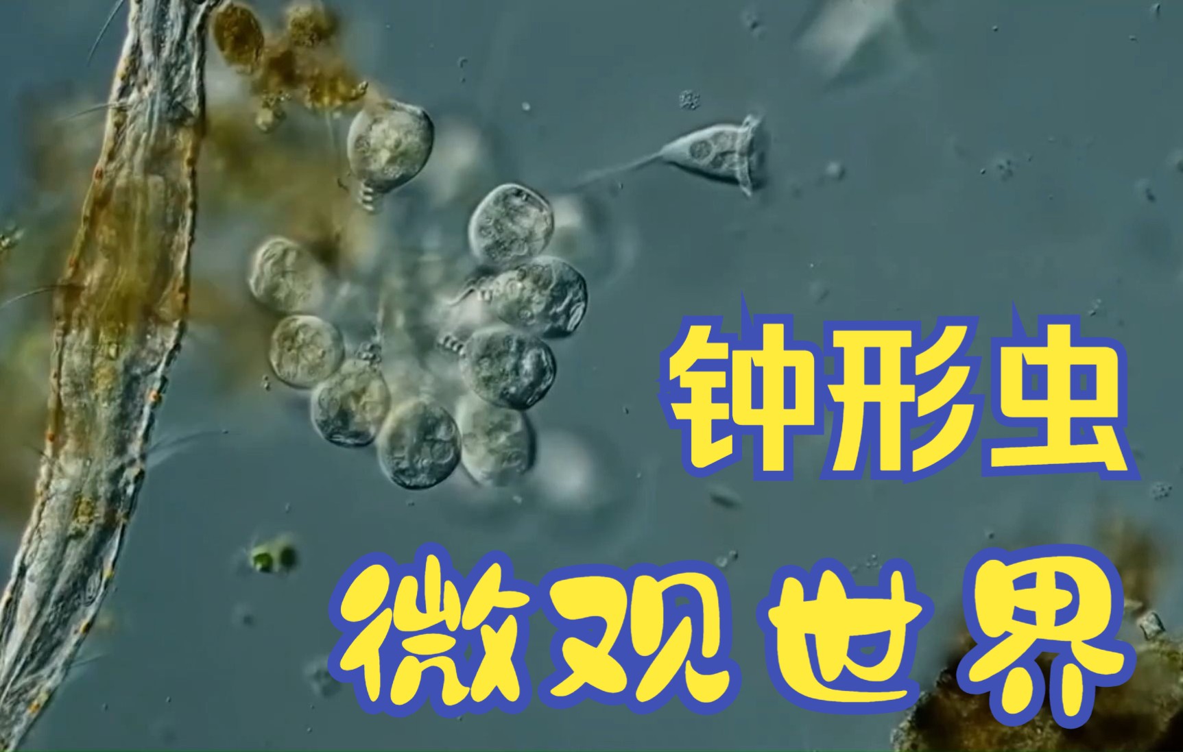 微生物世界之钟形虫哔哩哔哩bilibili