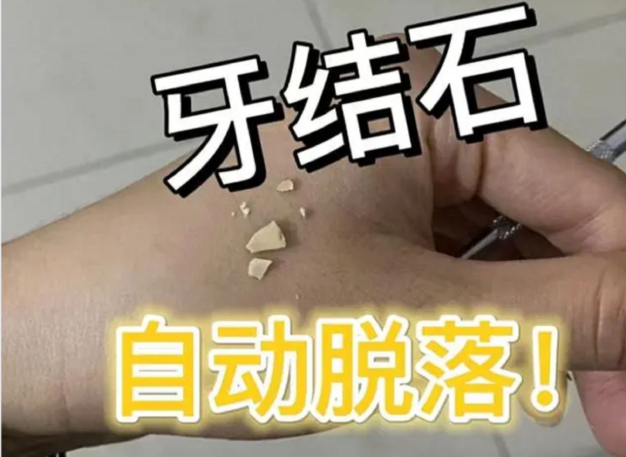 牙科生教你几个妙招,牙垢牙石唰唰掉!