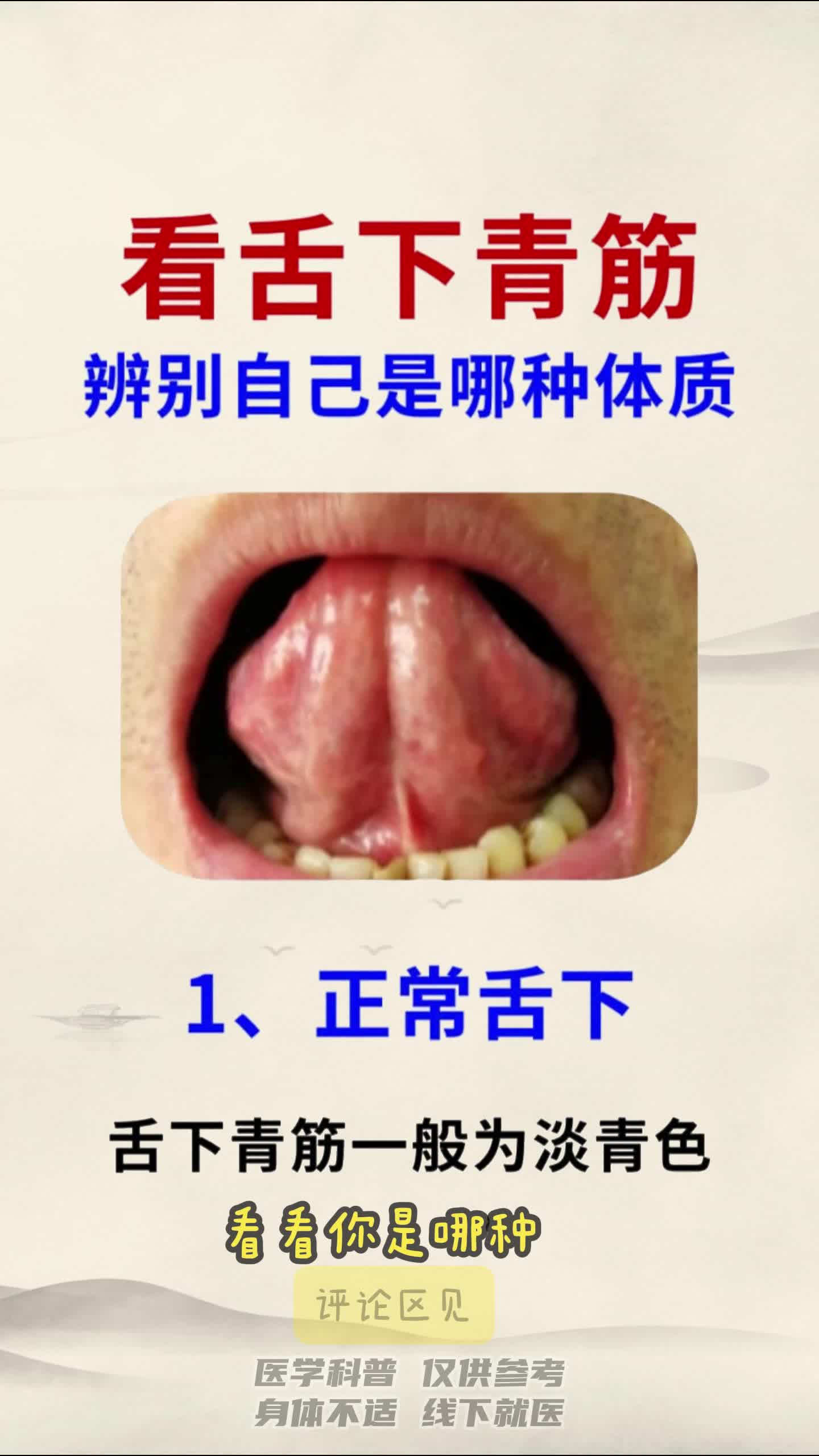 舌下的结构图片图片