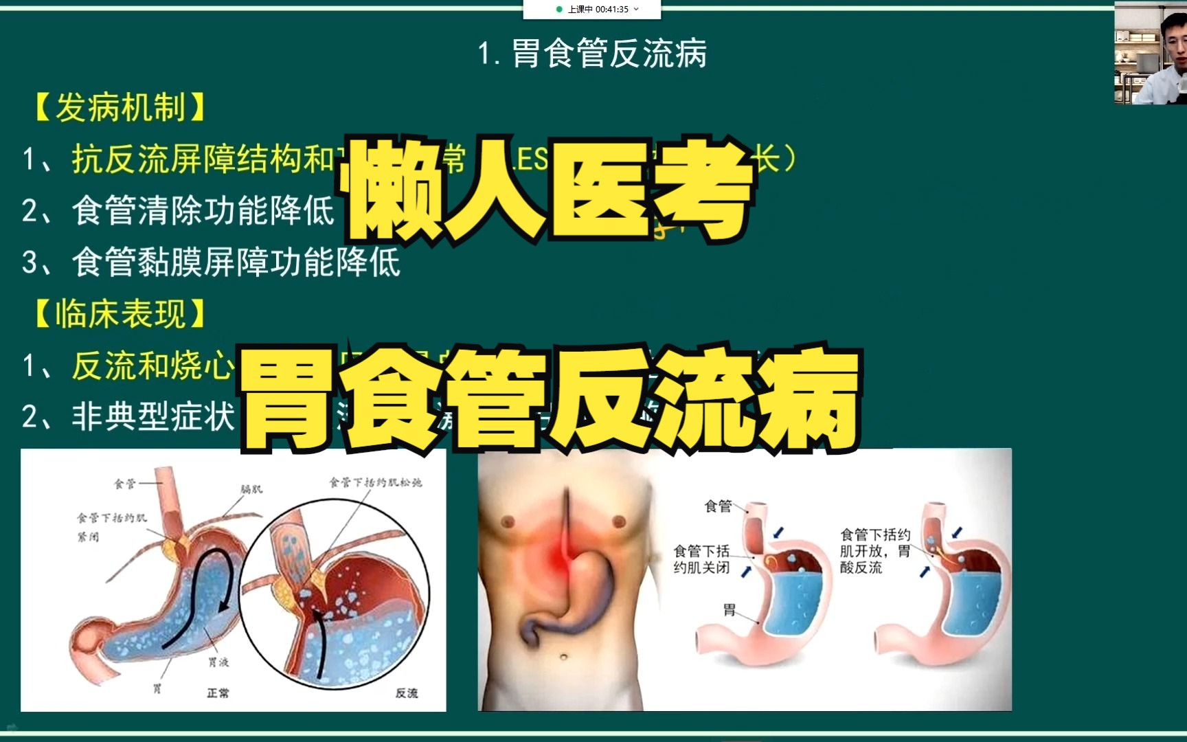 懒人医考宋阳老师 精讲消化系统胃食管反流病哔哩哔哩bilibili