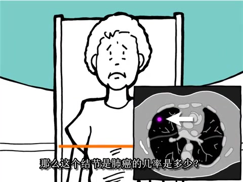 【NEJM Quicktake】肺癌高危者从小剂量CT筛查中获益最大哔哩哔哩bilibili