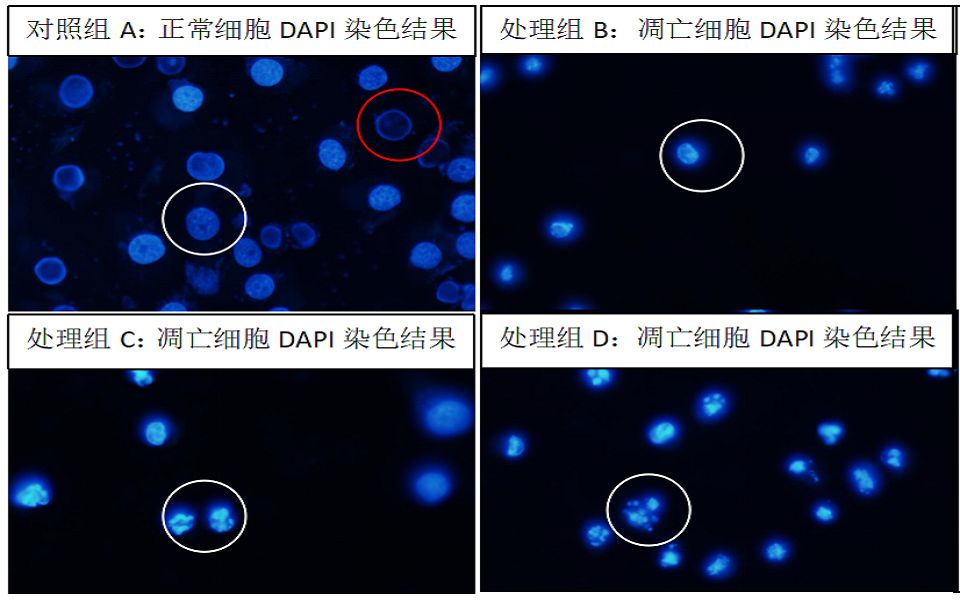 细胞生物学紫外线诱导细胞凋亡和DAPI直接染色法哔哩哔哩bilibili