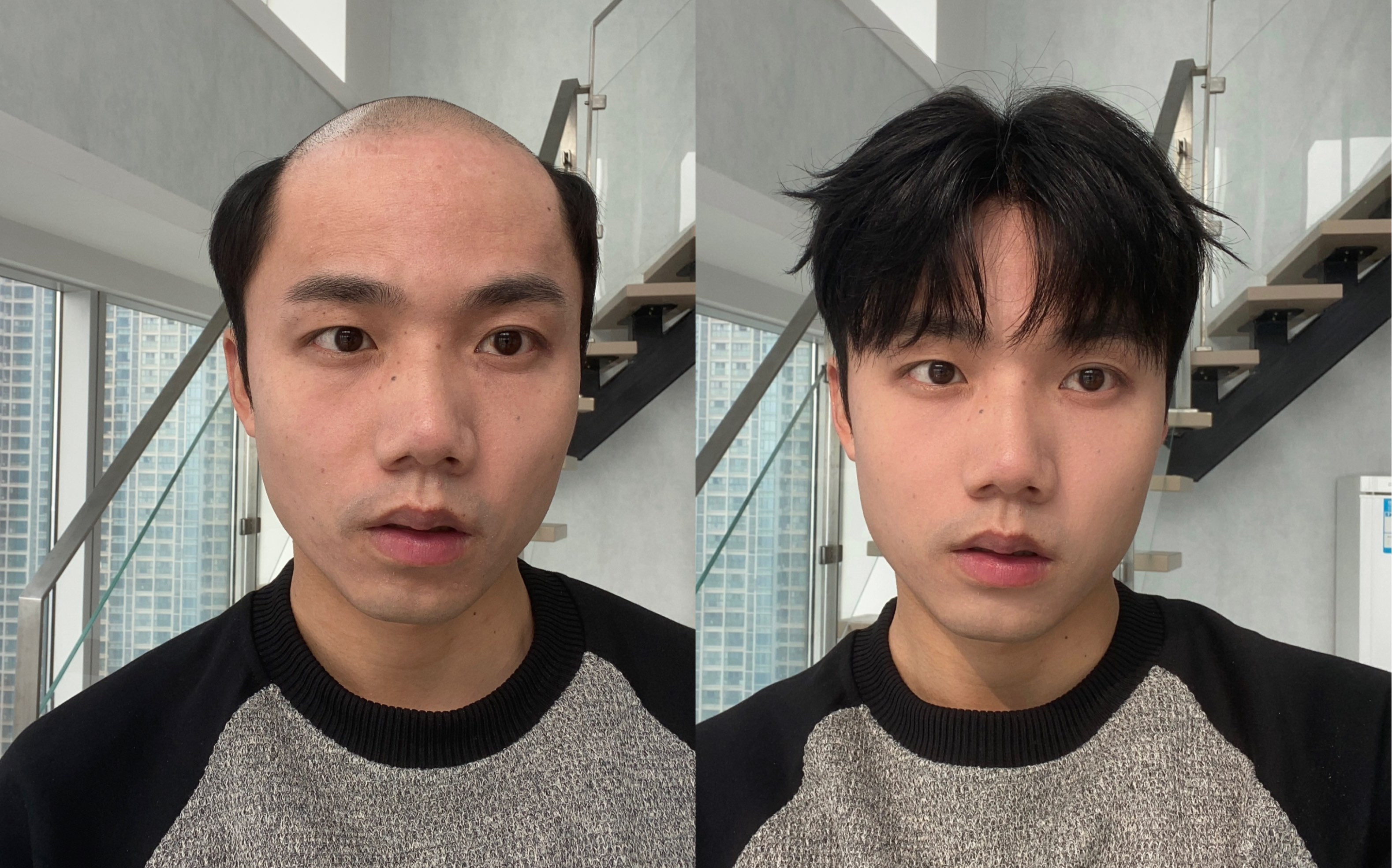 戴上假发,秒变男大,秃头男生的假发造型指南