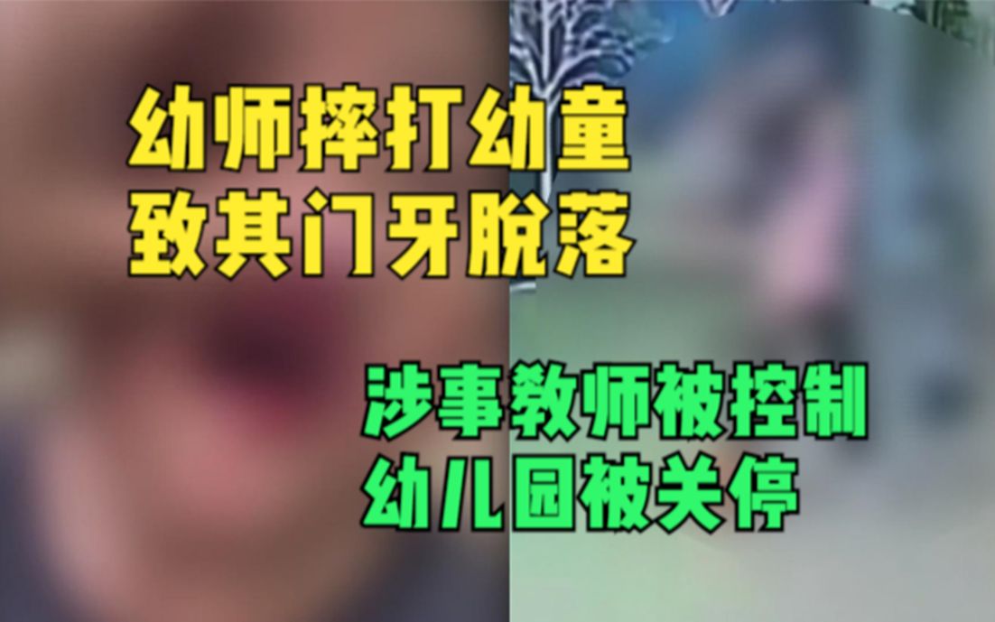 广东一幼师摔打幼童致其门牙脱落,涉事教师被控制,幼儿园被关停哔哩哔哩bilibili