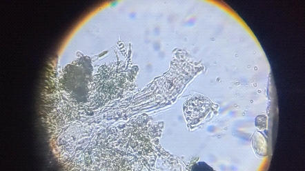 用孩子的显微镜观察到龟盆里的轮虫.