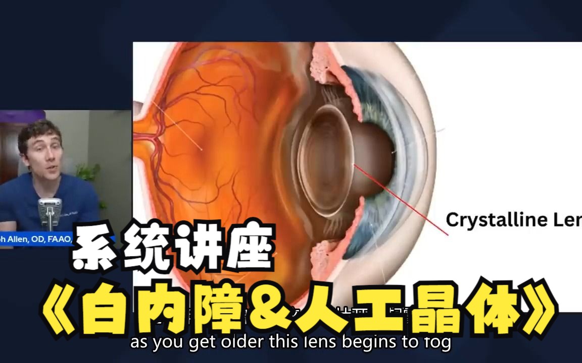 【中英双字】【白内障手术及人工晶体讲座】The BEST Cataract Surgery Lenses Options  Doctor Explains哔哩哔哩bilibili