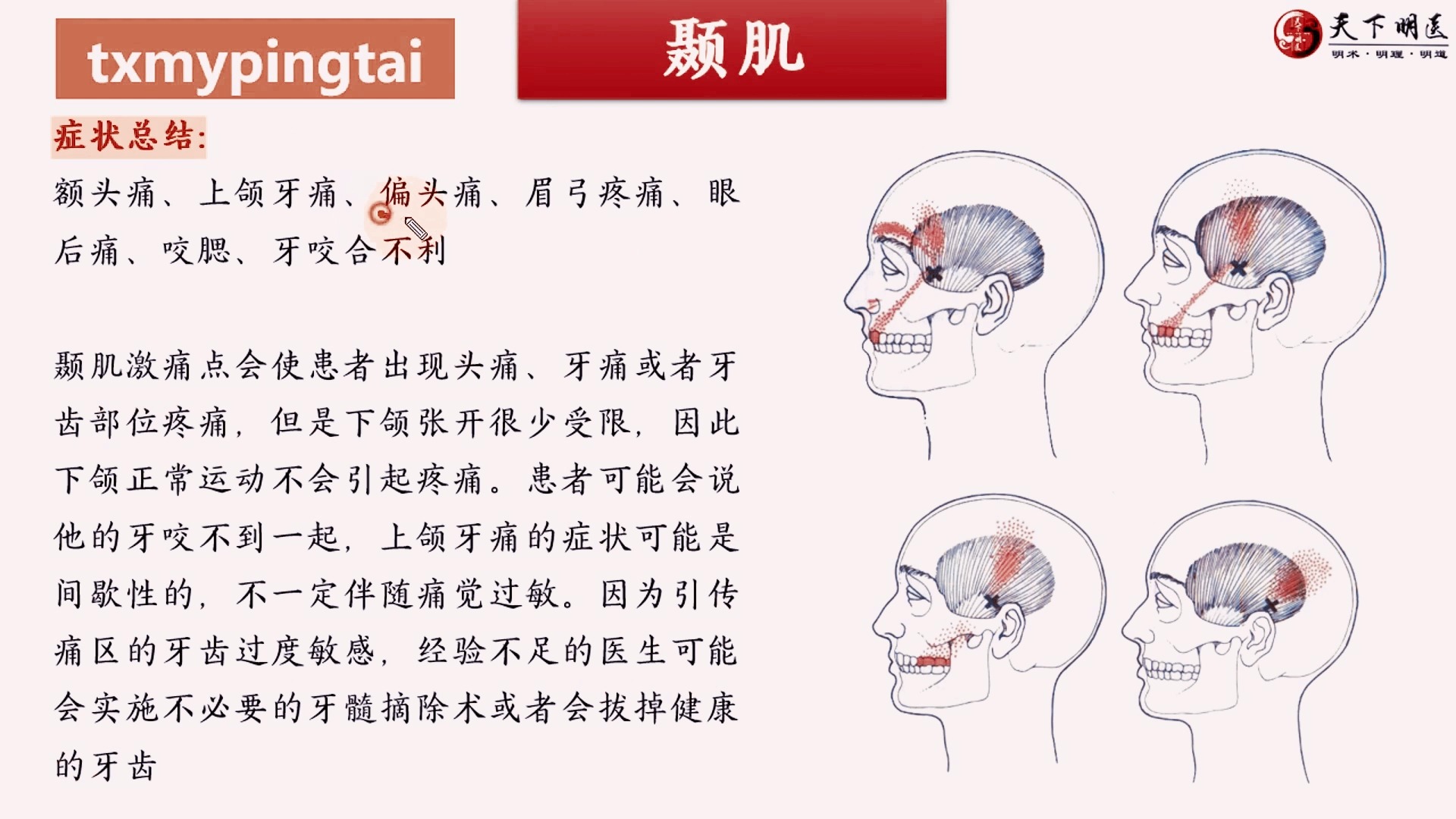 颞肌疼痛图片