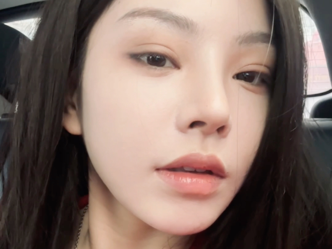 隐形牙套复查vlog—牙套妹