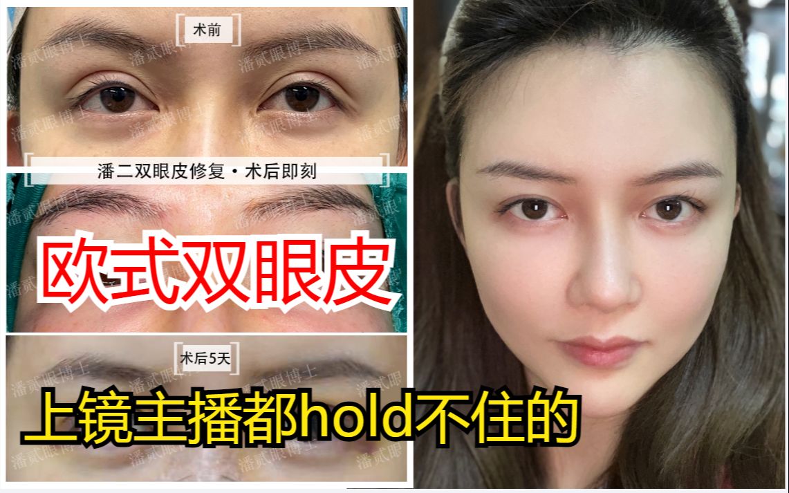 连上镜主播都hold不住的欧式双眼皮,你确定要做?哔哩哔哩bilibili