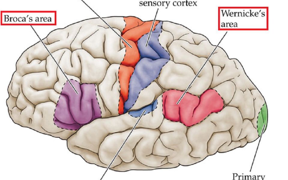 [图]失语症（布洛卡失语症Broca Aphasia)