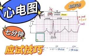 Download Video: [已更完] 7分钟掌握•心电图应试技巧（根据贺老师的课程总结归纳·考研/执医/规培/应试）心电图速成