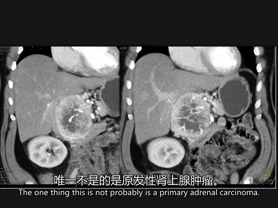 [图]医学影像英语视听 Abdomen01