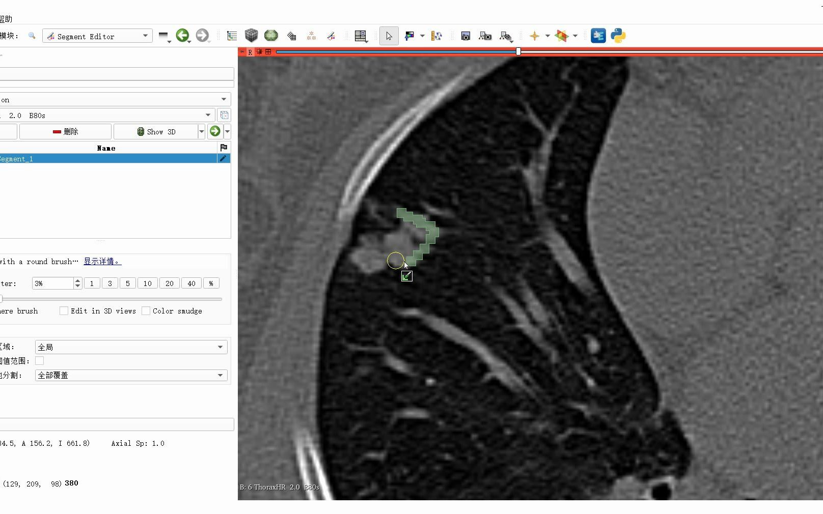 Slicer与Radiomics的使用教程哔哩哔哩bilibili