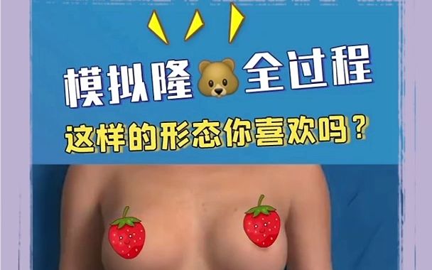 假体隆胸模拟过程哔哩哔哩bilibili