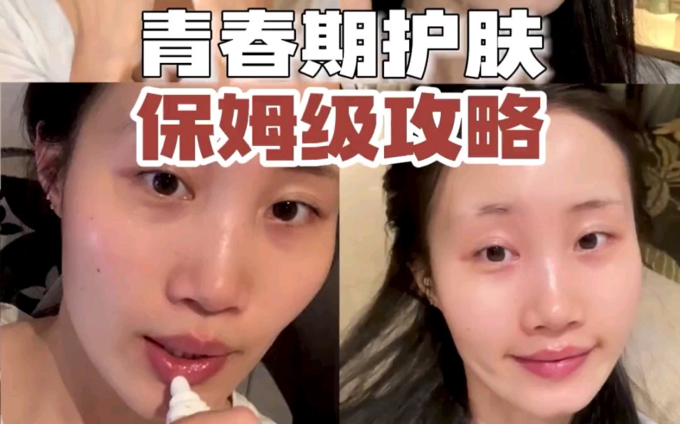 青春期才是养成好皮肤的黄金期!保姆级手把手教你怎么护肤,不用走弯路哔哩哔哩bilibili