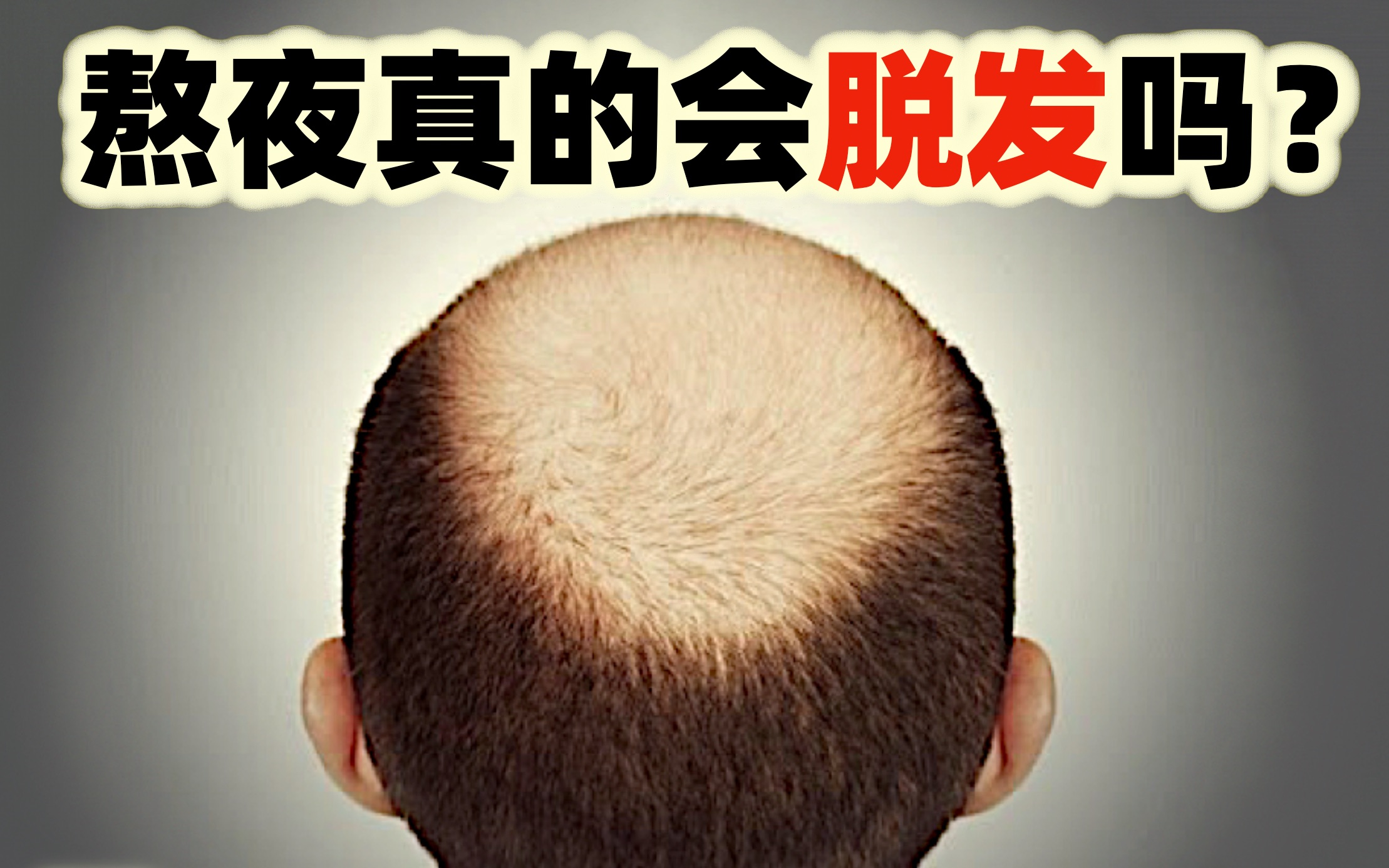【科普】熬夜会脱发吗?读博容易秃顶?